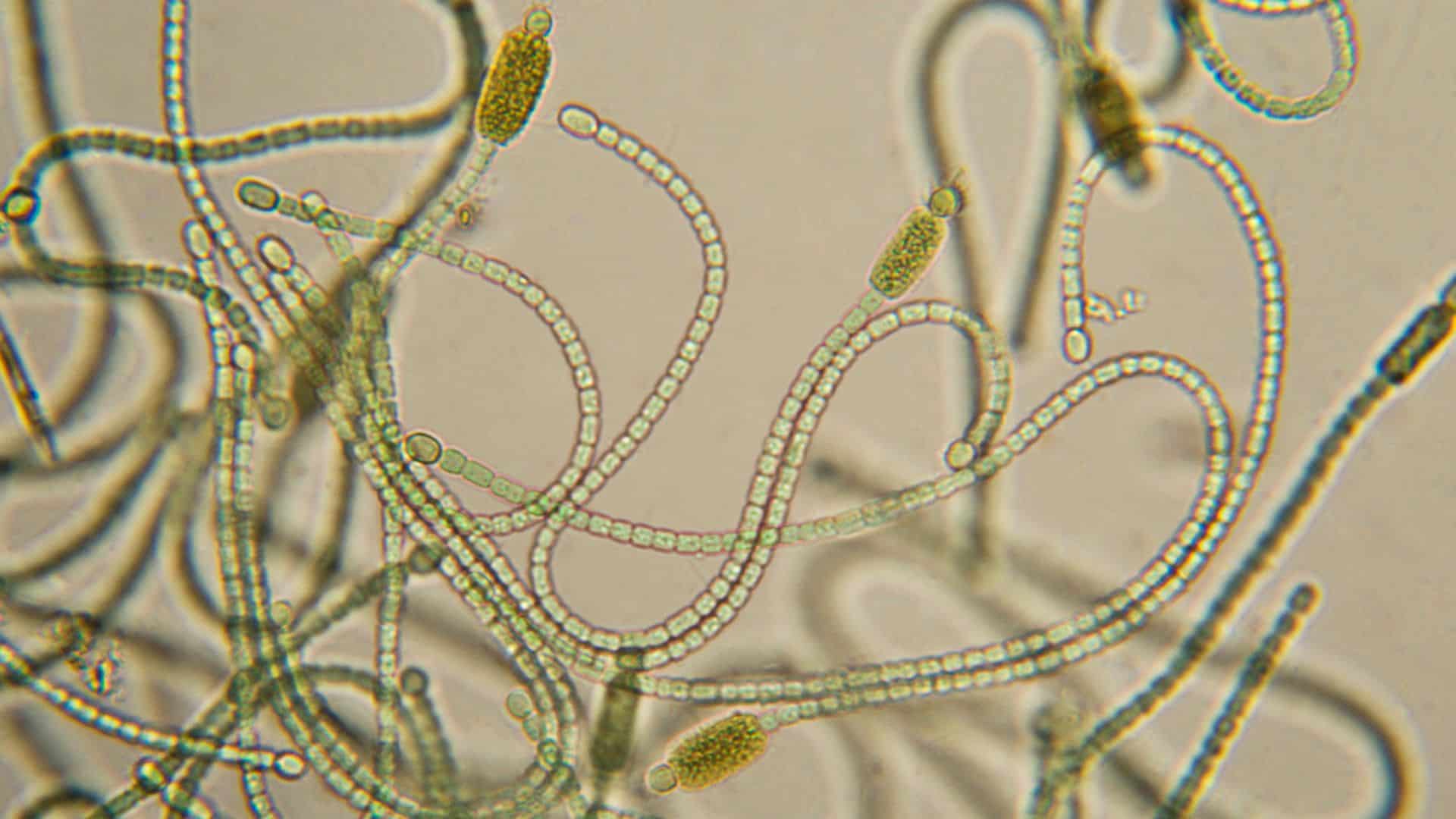 Cyanobacteria, or blue-green algae, under a microscope